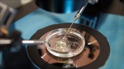 Νέα μέθοδος IVF υπόσχεται λιγότερη ταλαιπωρία και πιο γρήγορα αποτελέσματα