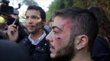 Τραυματισμός φοιτητή σε συμπλοκές με τα ΜΑΤ έξω από τη Νομική