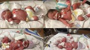 ΗΠΑ  - Φοίνιξ: Γέννησε υγιή τετράδυμα αλλά πέθανε